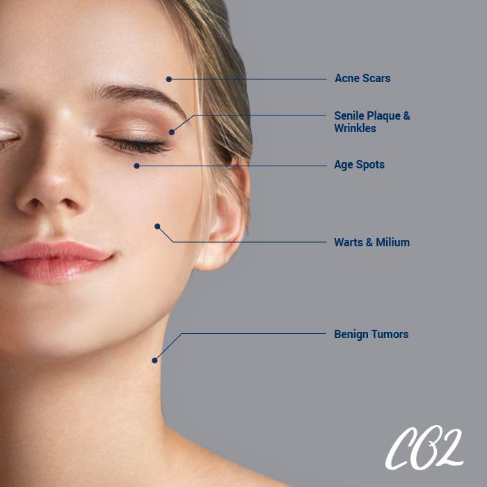 Co2 Face Treatment