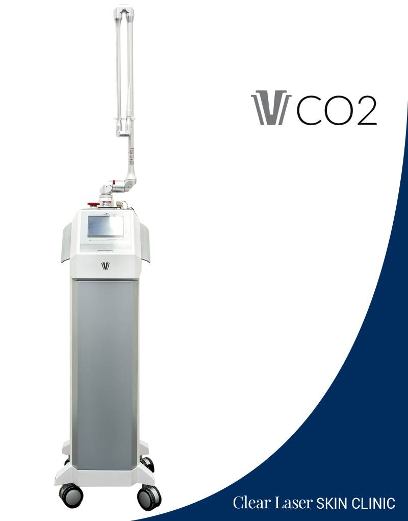 CO2 laser Equipment