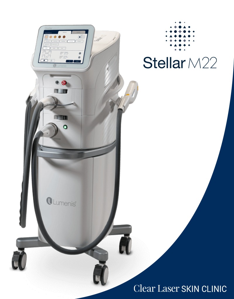 Clear Laser Skin Stella M22 equipment