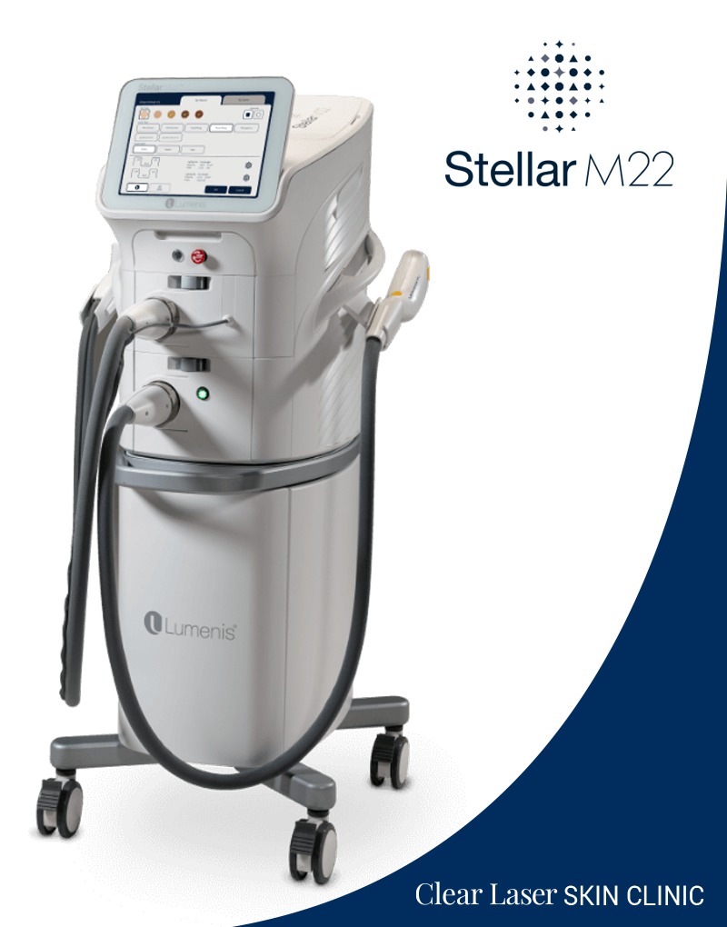 Clear Laser Skin Stellar M22 equipment